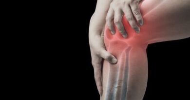 knee osteoarthritis