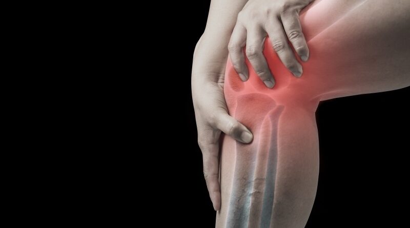 knee osteoarthritis